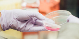 A lab tech examines a petri dish