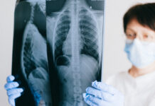 A chest X-ray can be used to diagnose pneumonia.